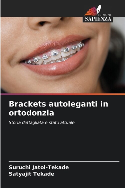 Brackets autoleganti in ortodonzia (Paperback)