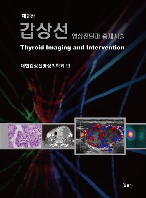 갑상선 : 영상진단과 중재시술