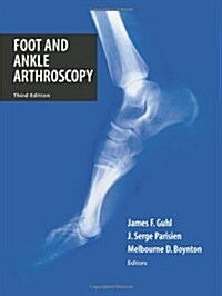 Foot and Ankle Arthroscopy (Paperback, 3, 2004. Softcover)
