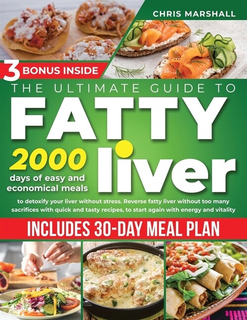 The Ultimate Guide to Fatty Liver Cookbook: 2000 days of Easy and Economical meals to Detoxify your Liver without stress. Reverse fatty liver without (Paperback)