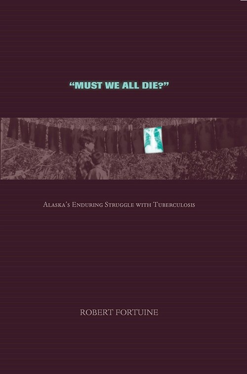 Must We All Die?: Alaskas Enduring Struggle with Tuberculosis (Paperback)