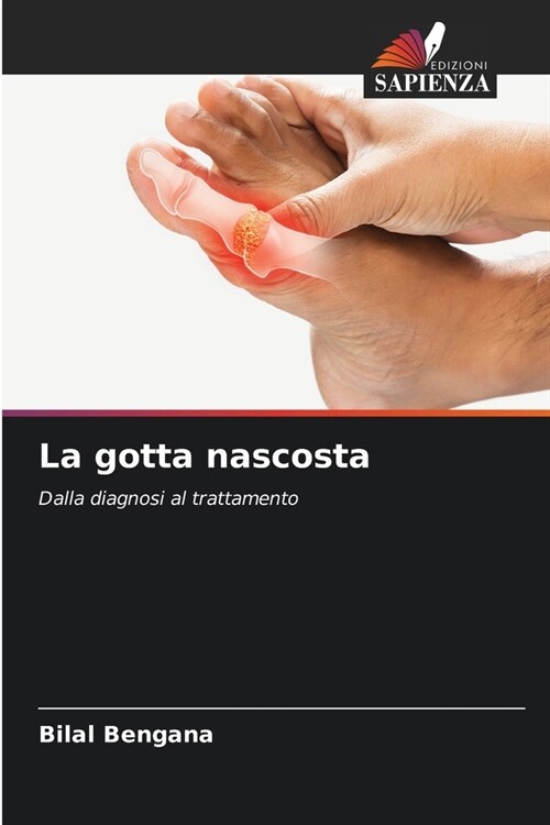 La gotta nascosta (Paperback)