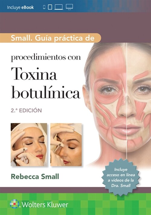 SMALL GUIA PRACTICA DE PROCEDIMIENTOS CON TOXINA BOTULINICA (Book)