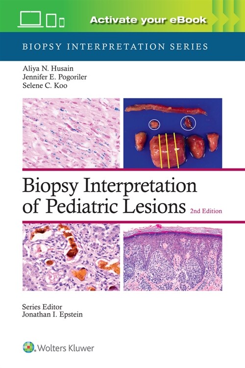 Biopsy Interpretation of Pediatric Lesions: Print + eBook with Multimedia (Hardcover, 2)