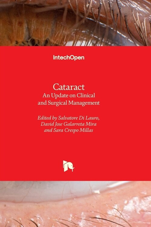 Cataract - An Update on Clinical and Surgical Management (Hardcover)