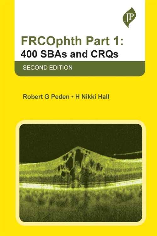 FRCOphth Part 1: 400 SBAs and CRQs (Paperback, 2 Revised edition)
