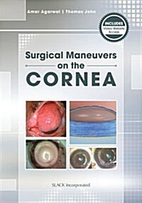[중고] Mastering Corneal Surgery: Recent Advances and Current Techniques (Paperback)