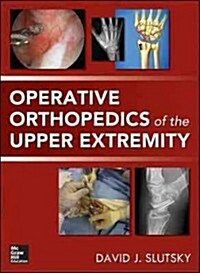 Operative Orthopedics of the Upper Extremity (Hardcover, 1st)