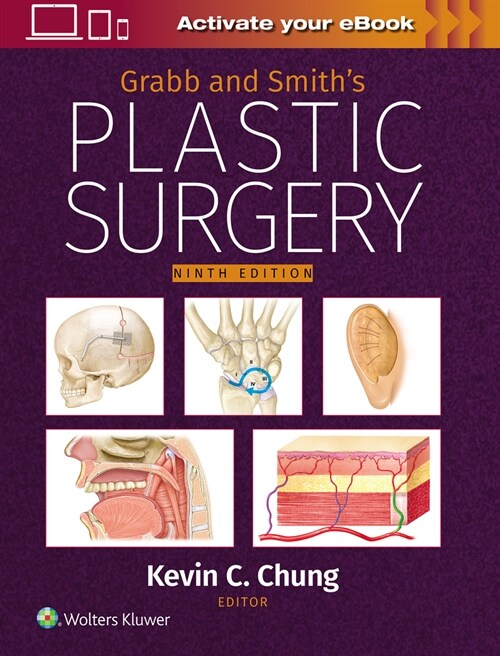 Grabb and Smiths Plastic Surgery: Print + eBook with Multimedia (Hardcover, 9)