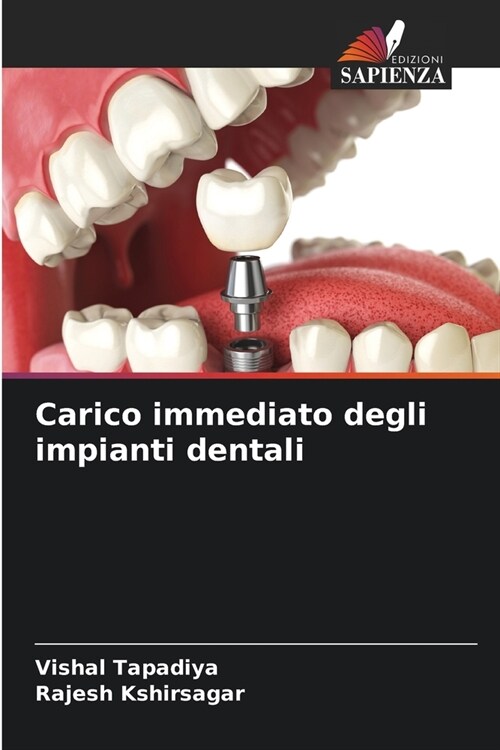 Carico immediato degli impianti dentali (Paperback)