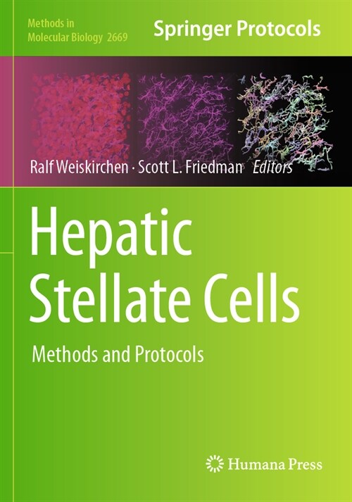 Hepatic Stellate Cells: Methods and Protocols (Paperback, 2023)