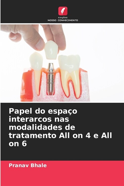 Papel do espa? interarcos nas modalidades de tratamento All on 4 e All on 6 (Paperback)