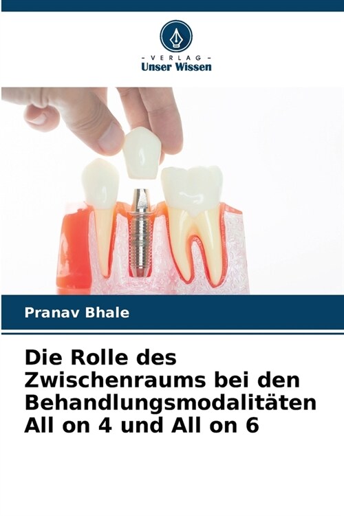 Die Rolle des Zwischenraums bei den Behandlungsmodalit?en All on 4 und All on 6 (Paperback)