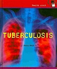 Tuberculosis (Library Binding)