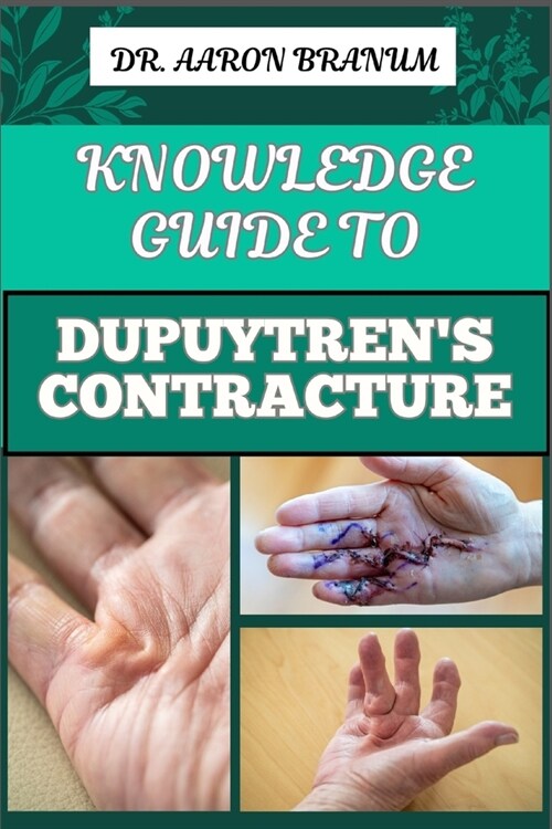 Knowledge Guide to Dupuytrens Contracture: Comprehensive Manual To Symptoms, Treatments, And Preventative Care For Hand Health And Mobility (Paperback)