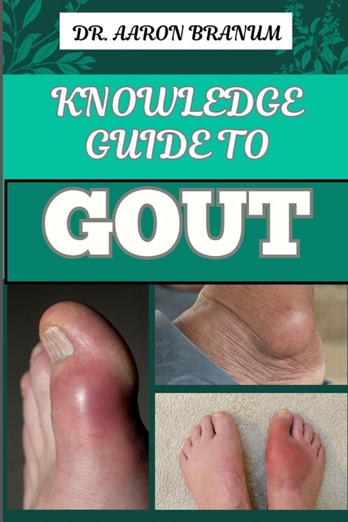 Knowledge Guide to Gout: Essential Manual To Symptoms, Treatments, Diets, And Natural Remedies For Lasting Relief (Paperback)