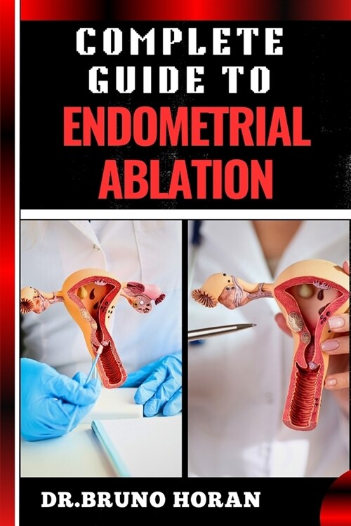 Complete Guide to Endometrial Ablation: Essential Manual To Minimally Invasive Treatment For Heavy Menstrual Bleeding, Uterine Health, And Long Term R (Paperback)