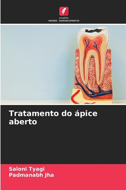 Tratamento do ?ice aberto (Paperback)