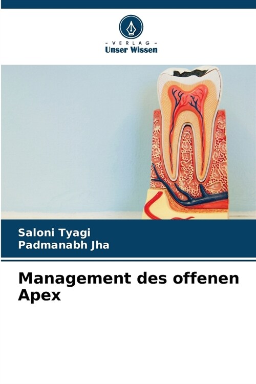 Management des offenen Apex (Paperback)