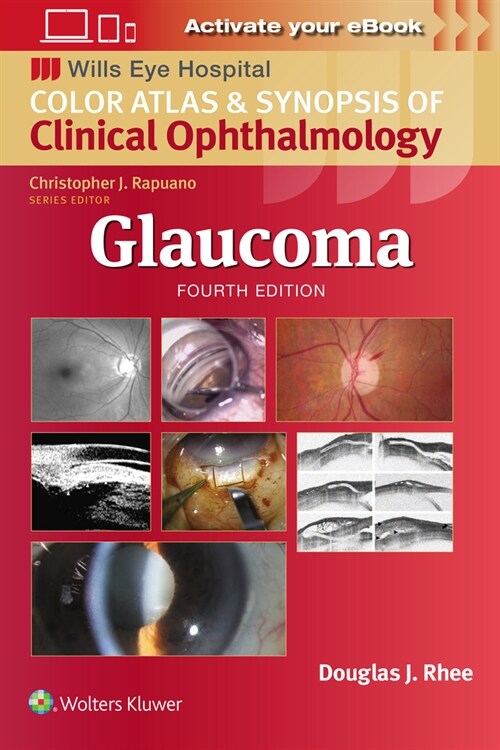 Glaucoma (Paperback, 4)