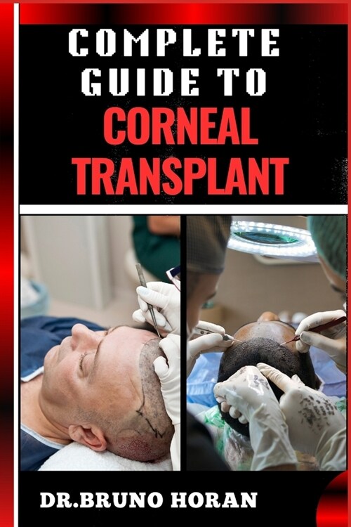 Complete Guide to Corneal Transplant: Essential Manual To Advanced Techniques, Patient Care, Recovery Tips, And Success Stories For Optimal Eye Health (Paperback)