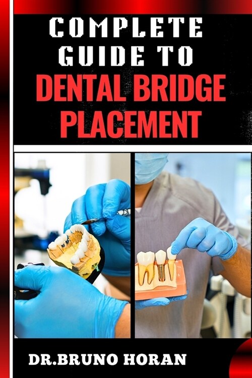 Complete Guide to Dental Bridge Placement: Comprehensive Manual To Restoring Smiles, Improving Oral Health, And Ensuring Long Lasting Tooth Solutions (Paperback)
