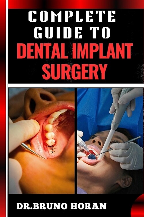 Complete Guide to Dental Implant Surgery: Comprehensive Manual To Advanced Techniques, Recovery, and Best Practices for Optimal Oral Health (Paperback)