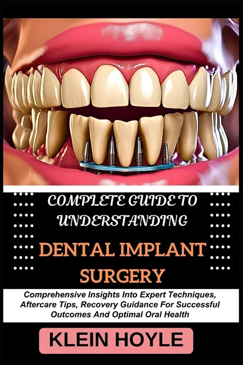 Complete Guide to Understanding Dental Implant Surgery: Comprehensive Insights Into Expert Techniques, Aftercare Tips, Recovery Guidance For Successfu (Paperback)