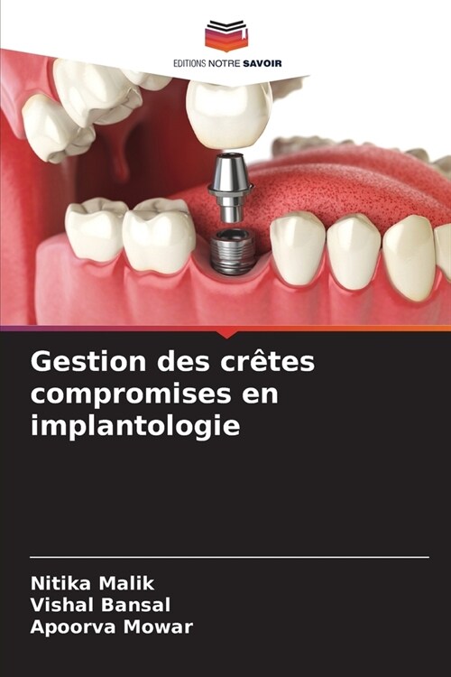 Gestion des cr?es compromises en implantologie (Paperback)