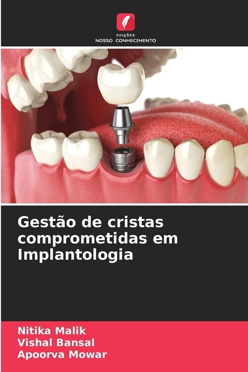 Gest? de cristas comprometidas em Implantologia (Paperback)