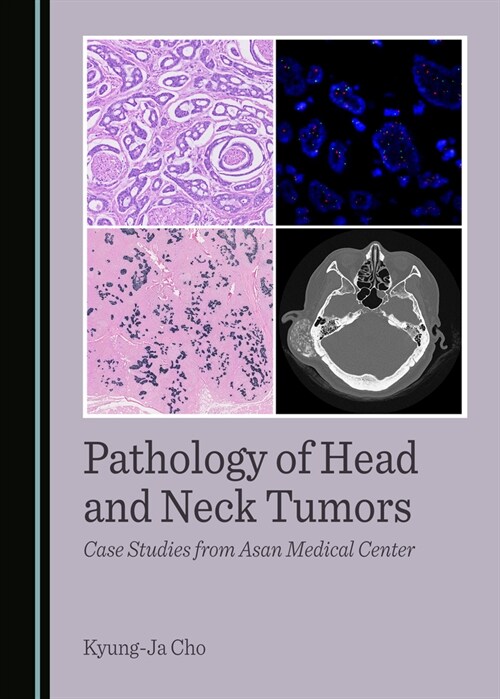 Pathology of Head and Neck Tumors: Case Studies from Asan Medical Center (Hardcover)