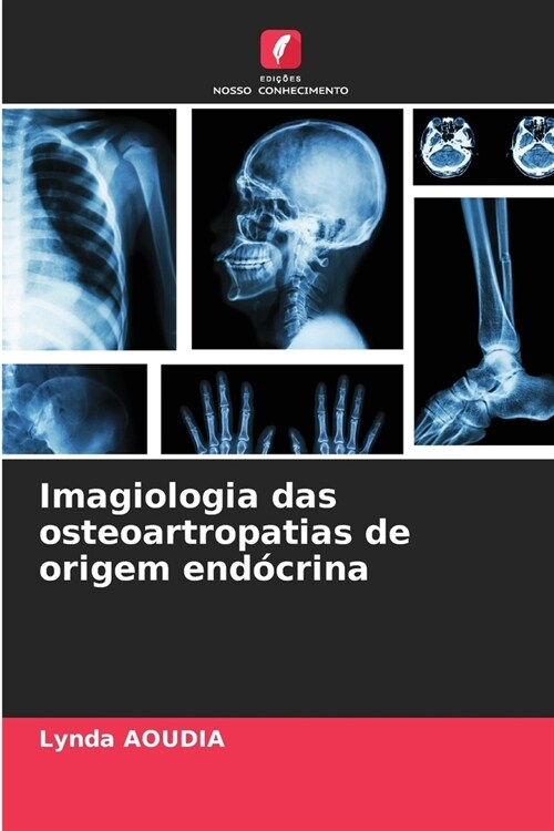 Imagiologia das osteoartropatias de origem end?rina (Paperback)