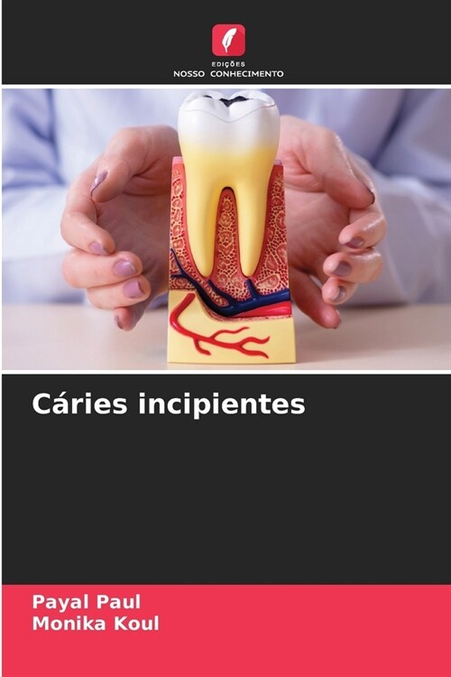 C?ies incipientes (Paperback)