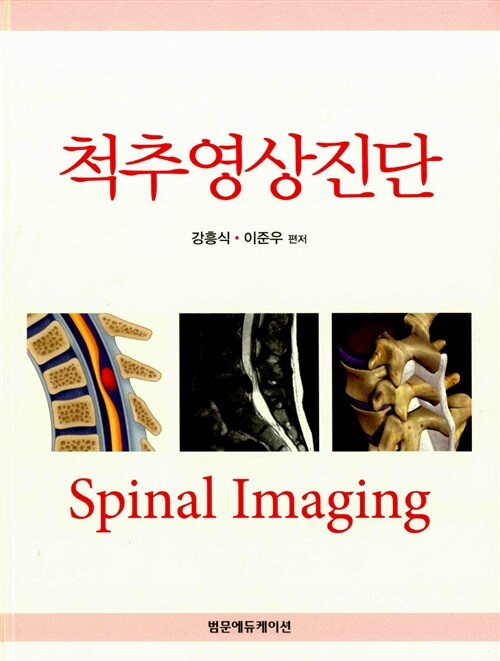 [중고] 척추영상진단 Spinal Imaging