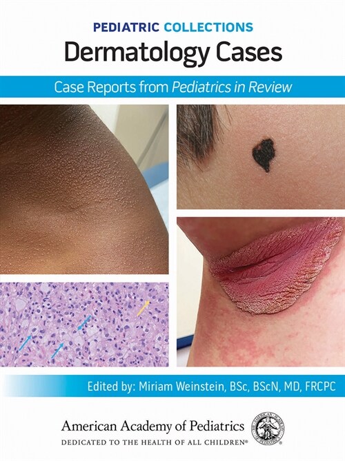 Pediatric Collections: Dermatology Cases: Case Reports from Pediatrics in Review (Paperback)