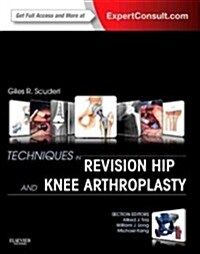 Techniques in Revision Hip and Knee Arthroplasty (Hardcover)