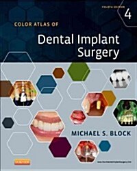 Color Atlas of Dental Implant Surgery (Hardcover, 4 ed)