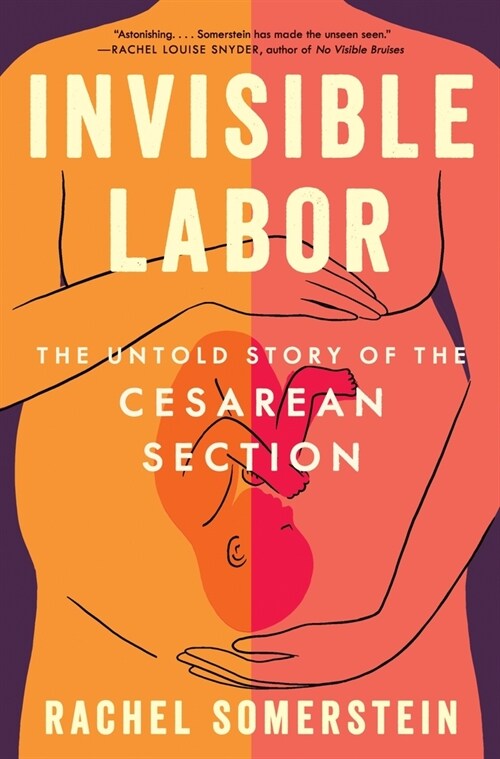 Invisible Labor: The Untold Story of the Cesarean Section (Paperback)