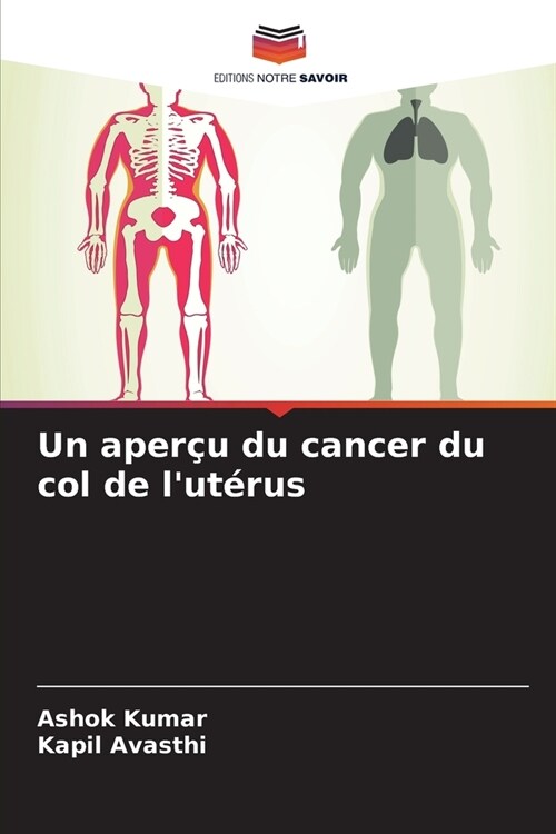 Un aper? du cancer du col de lut?us (Paperback)