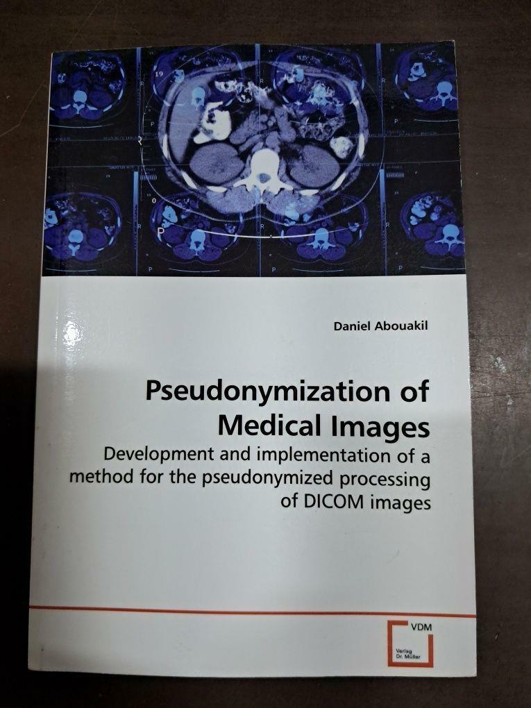 [중고] Pseudonymization of Medical Images (Paperback)