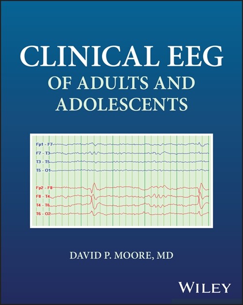 Clinical EEG of Adults and Adolescents (Paperback)