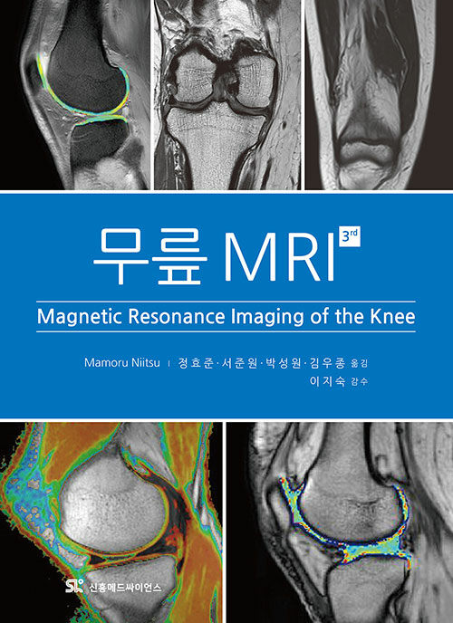 무릎 MRI