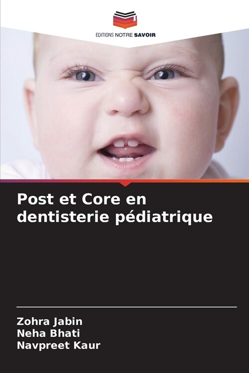 Post et Core en dentisterie p?iatrique (Paperback)