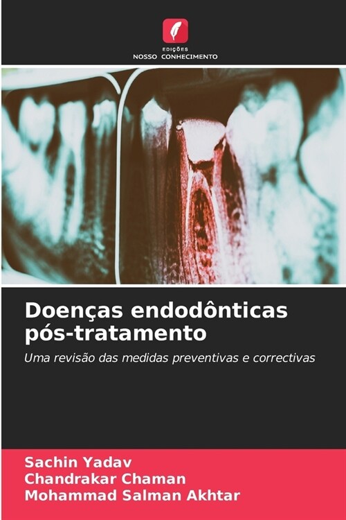 Doen?s endod?ticas p?-tratamento (Paperback)