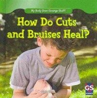 How Do Cuts and Bruises Heal? (Library Binding)