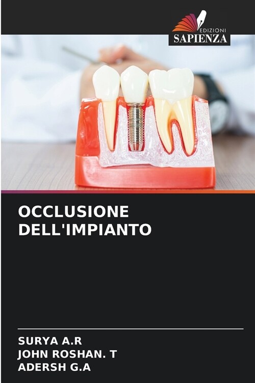 Occlusione Dellimpianto (Paperback)