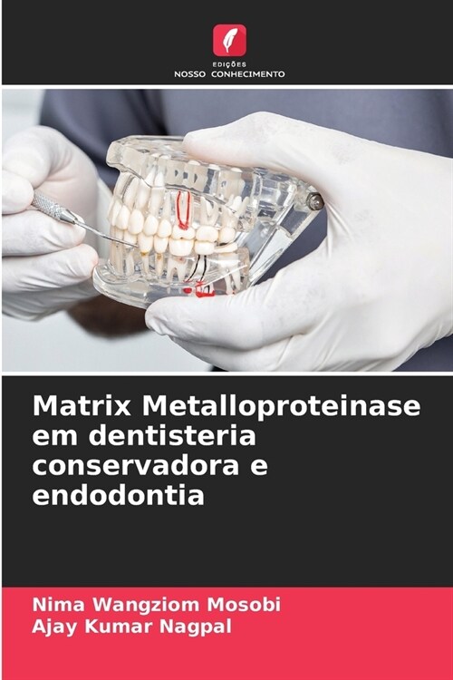 Matrix Metalloproteinase em dentisteria conservadora e endodontia (Paperback)