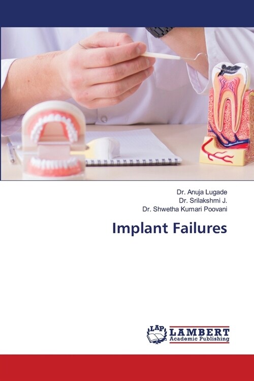 Implant Failures (Paperback)