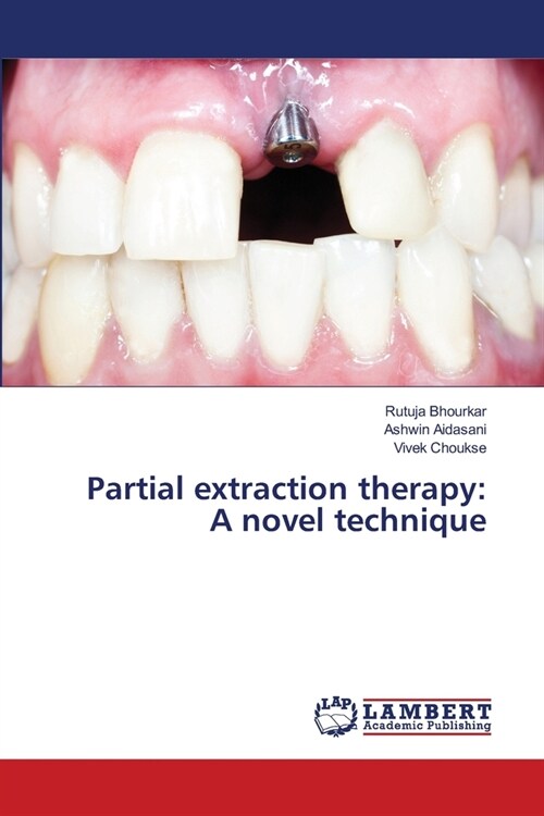 Partial extraction therapy: A novel technique (Paperback)