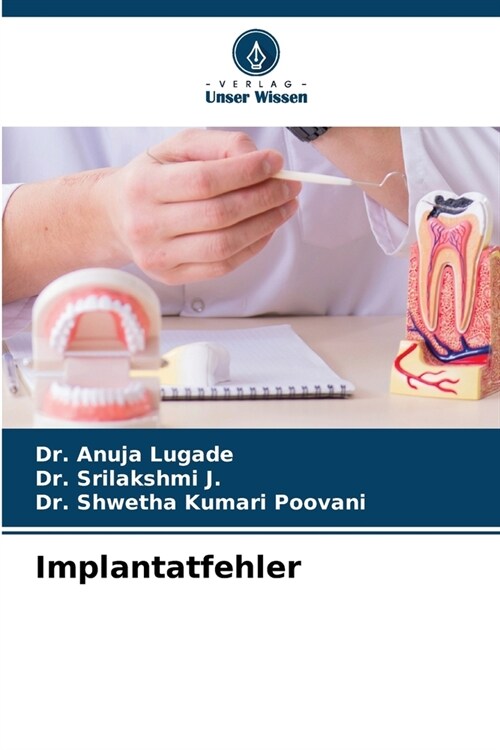 Implantatfehler (Paperback)